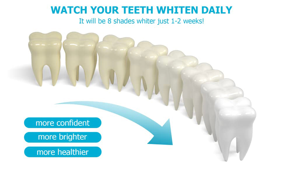Professional Teeth Whitening Kit – 5X LED Light with Pens & Mouth Tray