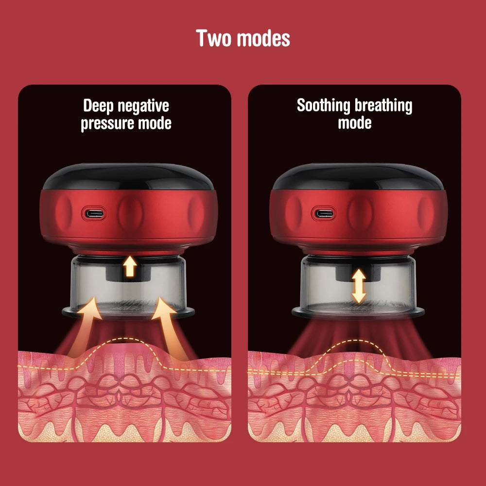 Electric Vacuum Cupping Massager – Anti-Cellulite Slimming Therapy Tool
