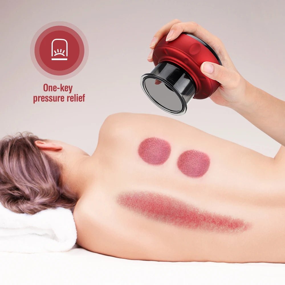 Electric Vacuum Cupping Massager – Anti-Cellulite Slimming Therapy Tool