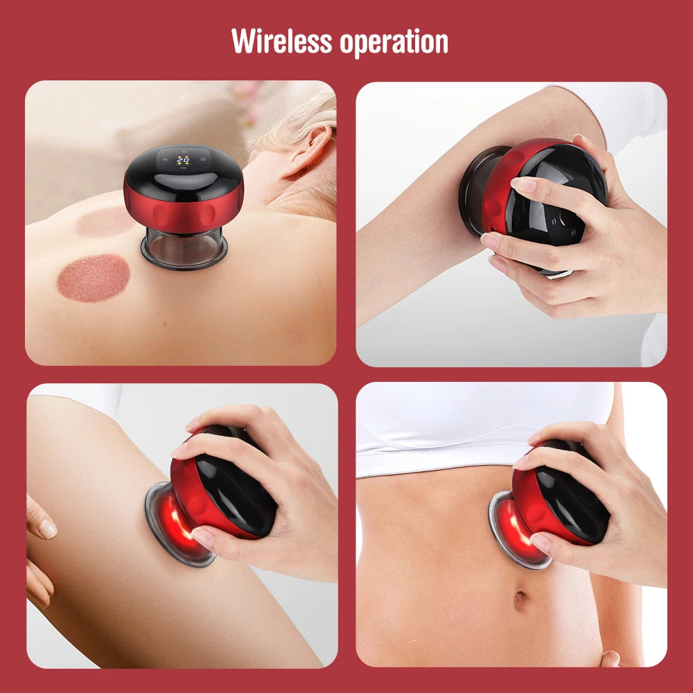 Electric Vacuum Cupping Massager – Anti-Cellulite Slimming Therapy Tool